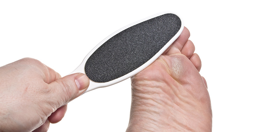 Hornhaut natürlich und schonend entfernen