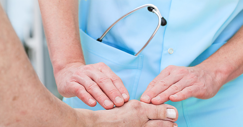 Hallux valgus – Wenn der Ballenzeh Schmerzen verursacht