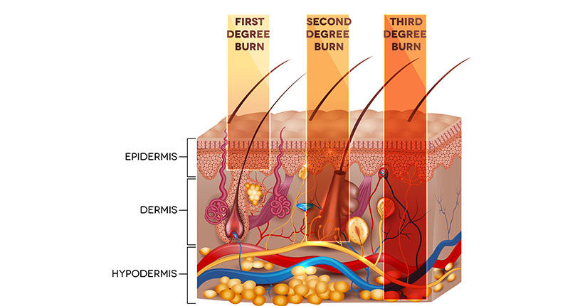 Die Haut – ein ganz besonderes Organ
