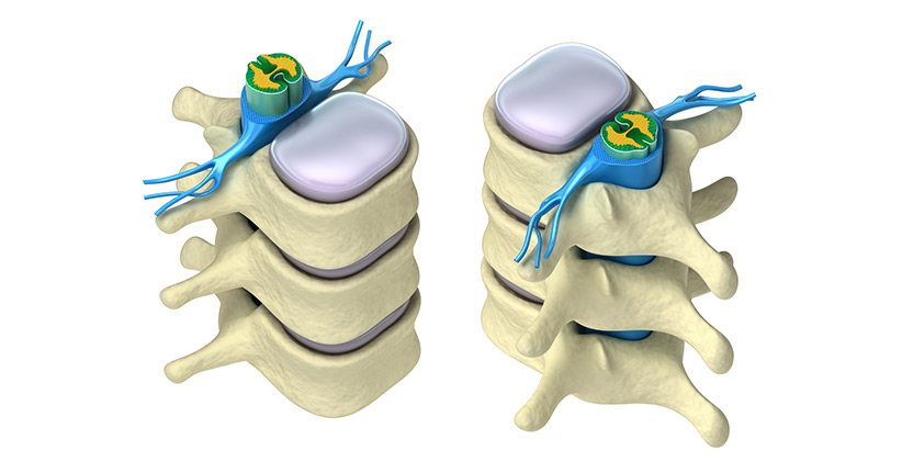 Das Rückenmark – die Verbindung zwischen Körper und Geist