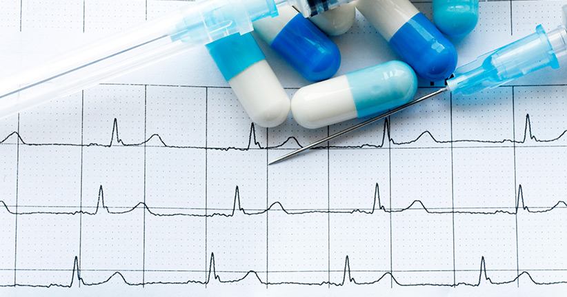 Das WPW-Syndrom – wenn das Herz aus dem Takt gerät