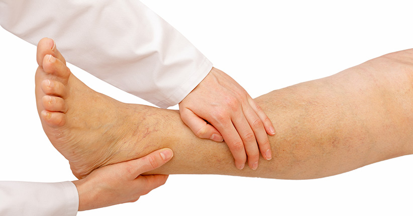 Wassereinlagerungen im Gewebe – immer ein Fall für den Arzt?