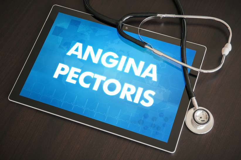 Angina pectoris – Ursachen und Behandlung